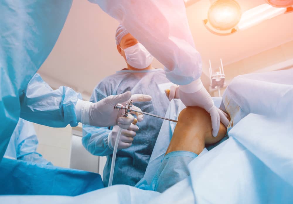 Arthroscopic Rotator Cuff Repair Surgeons in Panchkula